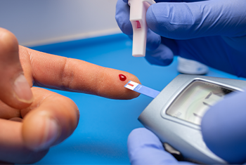 Cholesterol Test